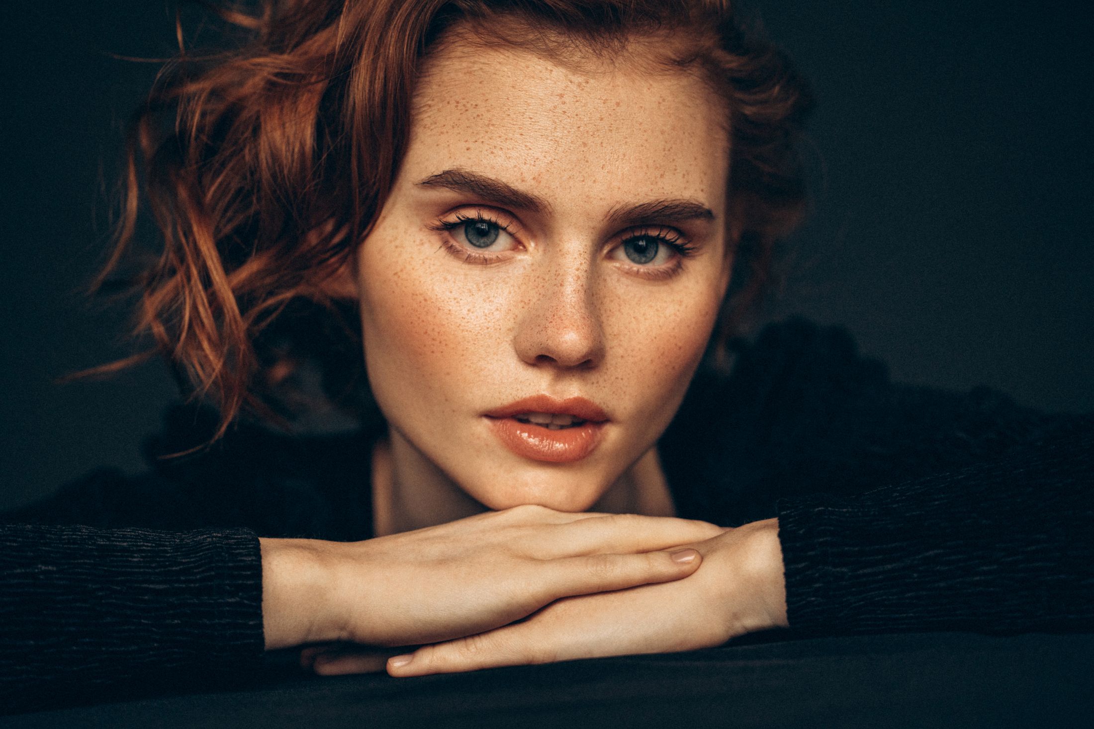Freckled woman resting her chin on hands.